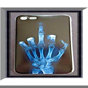 Black & White Silicone Iphone 8 Case Middle Finger X-Ray Skeleton Design
